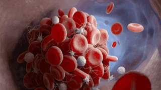 Study Reveals F11R/JAM-A’s Role in Platelet-Mediated Thrombus Formation