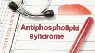 Antiphospholipid Syndrome (APS) Management: A 2024 Update and Review