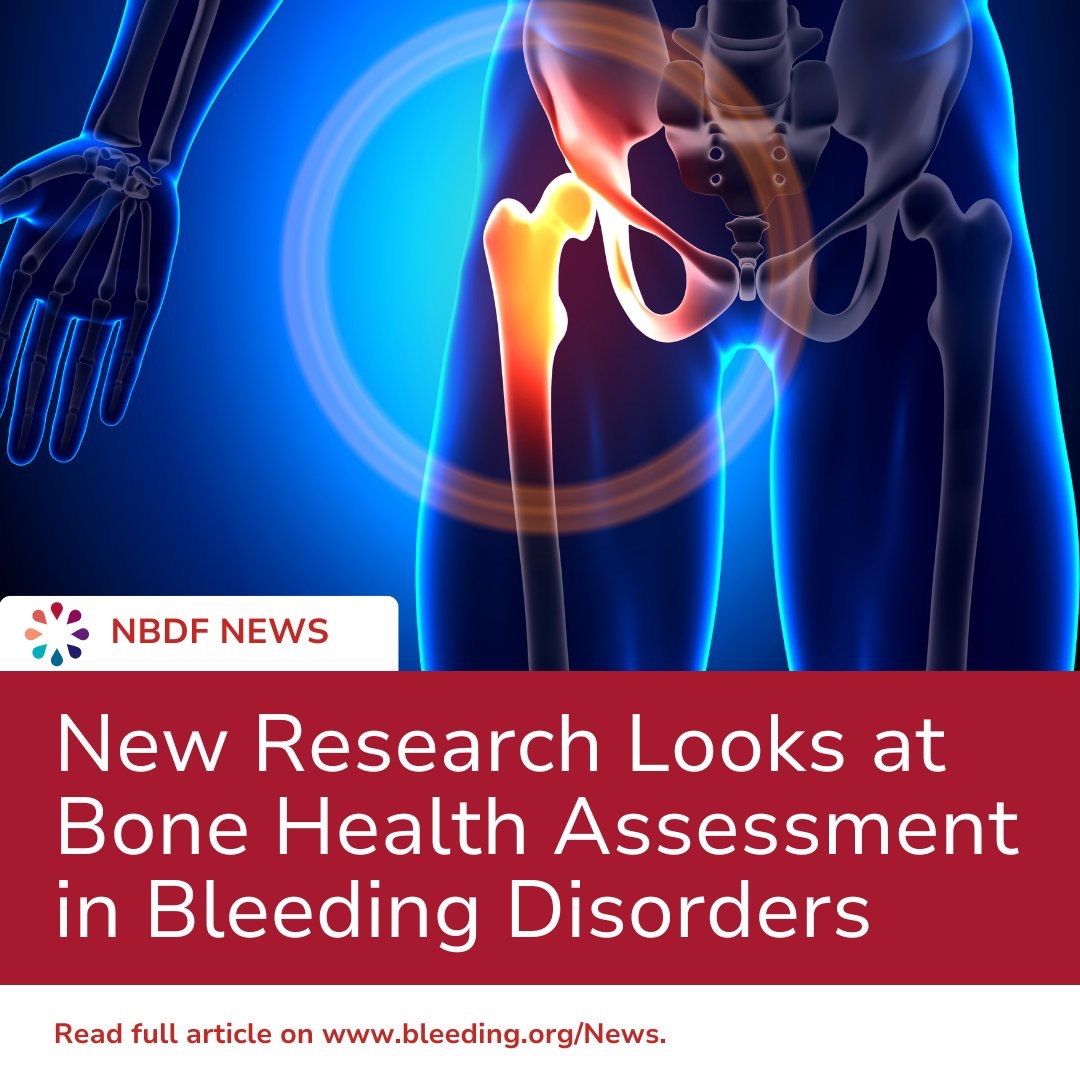 Journal Hemophilia on Bone Health | Vitamin D, DEXA Scans and Bleeding Disorders?