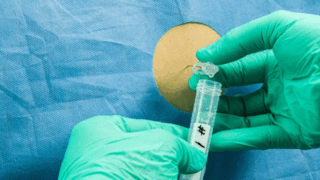 Balancing Bleeding and Clotting Risks: Updated LP Guidelines in Antithrombotic Care- by Dr. Chokri Ben Lamines