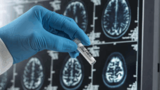 Alzheimer’s Blood Test Can Spot People With Early Symptoms