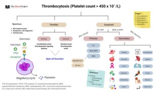 Unmasking Thrombocytosis: What a High Platelet Count Really Means