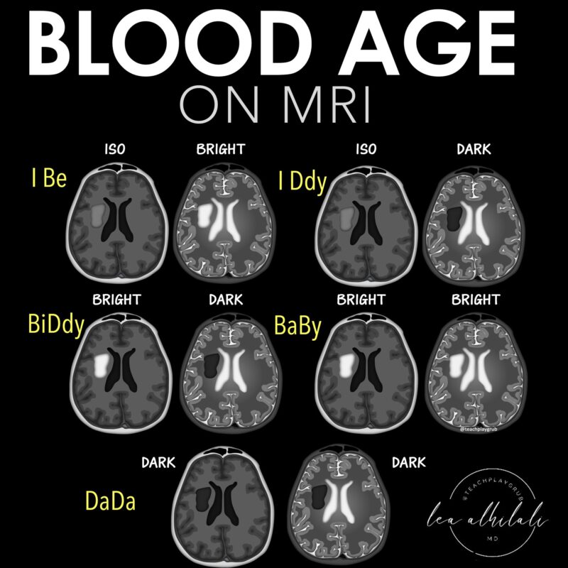 Lea Alhilali: Do You Know How to Tell the Age of Blood on MRI?