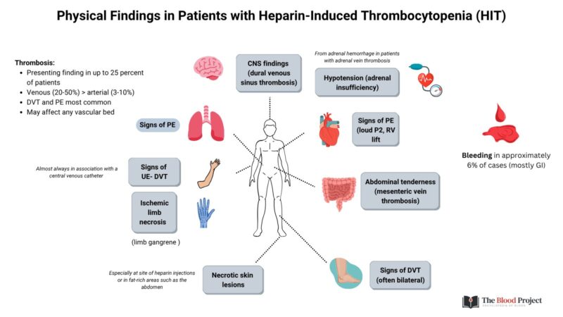 William Aird: Don’t Expect Bleeding - Look for Thrombosis