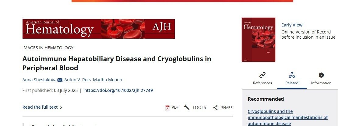 Phagocytosed Clues: A Cryoglobulinemia Case Unfolds at the Microscopic Level-by the American Journal of Hematology