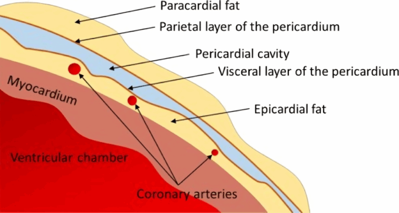 Coronary Arteries, Pericardial Cavity, and the Hidden Danger of Cardiac Tamponade During PCI-By Ahmed Ata