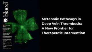 Metabolic Reprogramming in Deep Vein Thrombosis: A Novel Therapeutic Avenue Beyond Anticoagulation