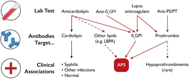 Jason S Knight: Antiphospholipid Syndrome Review