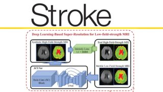 Explore July 2025 Stroke Highlights by Dr Jose Rafael Romero