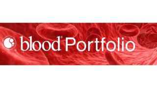 ChAdOx1 and Shear‑Dependent Platelet Aggregation: Uncovering a New Thrombotic Pathway