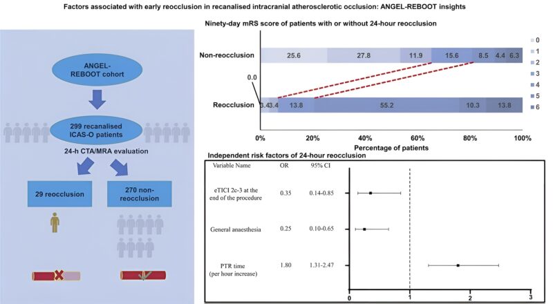 3 Valuable Takeaways from the ANGEL-REBOOT Trial for ICAS-O Stroke