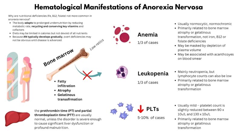 William Aird on Hematological Manifestations of Anorexia Nervosa