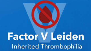 Factor V Leiden: Quick Facts