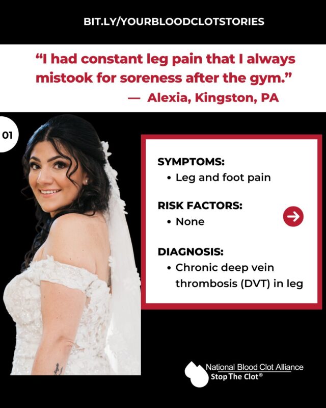 NBCA: Alexis’s DVT Diagnosis Came Without Warning - Learn How She Caught It Early