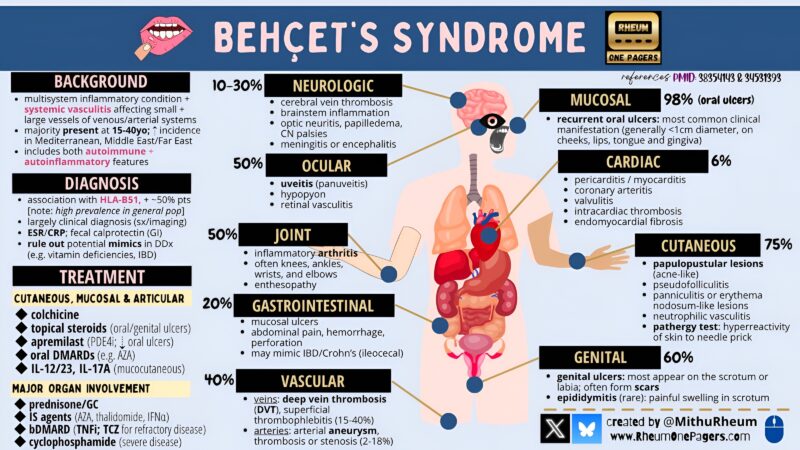 Vasculitis
