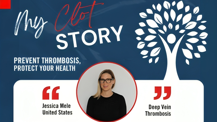 Jessica Mele’s Clot Story: Recognizing the Hidden Risks of Deep Vein Thrombosis