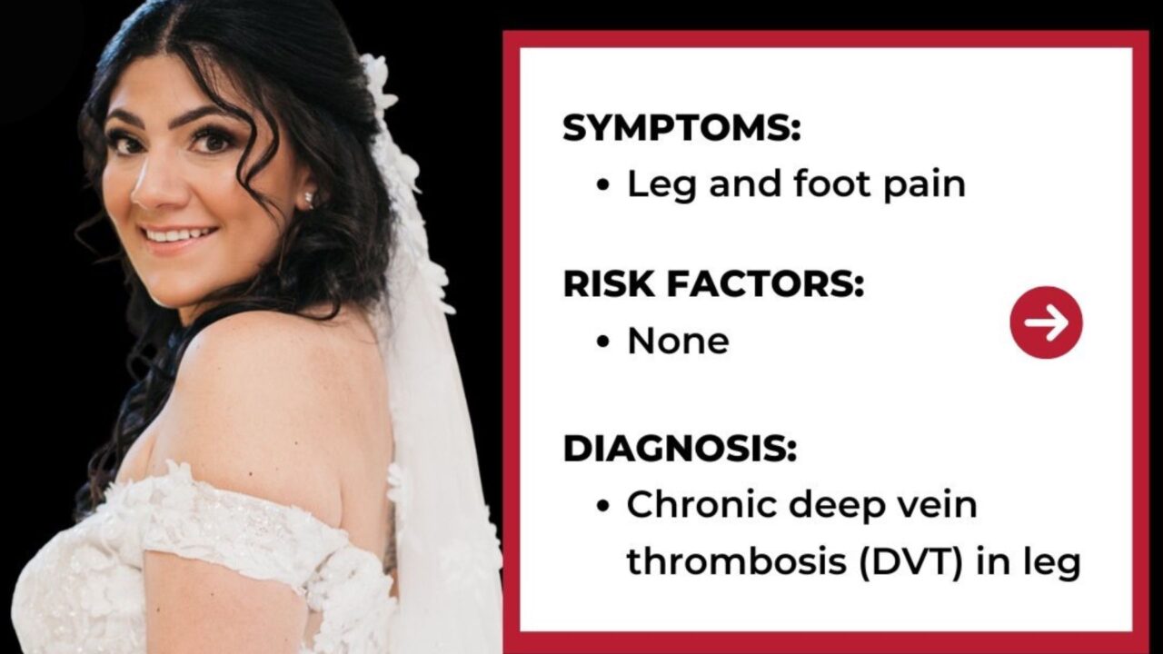 NBCA: Alexis’s DVT Diagnosis Came Without Warning – Learn How She Caught It Early