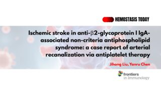 Case Report Alert: Basilar Artery Occlusion in IgA-APS