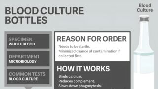 Order of Draw Matters: Phlebotomy Tips for Reliable Test Results by Naveed Hussain