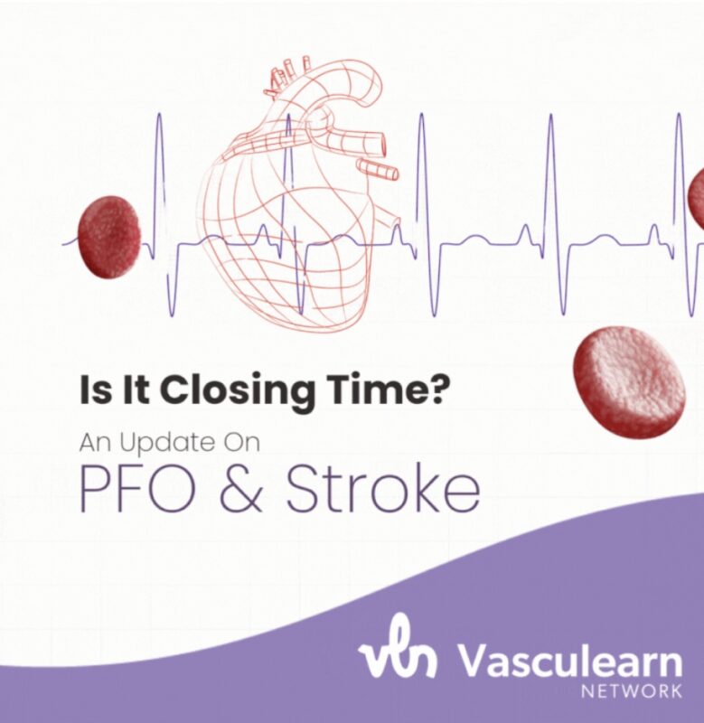 Patent Foramen Ovale and Stroke: David Kent and Andy Wang Break It Down