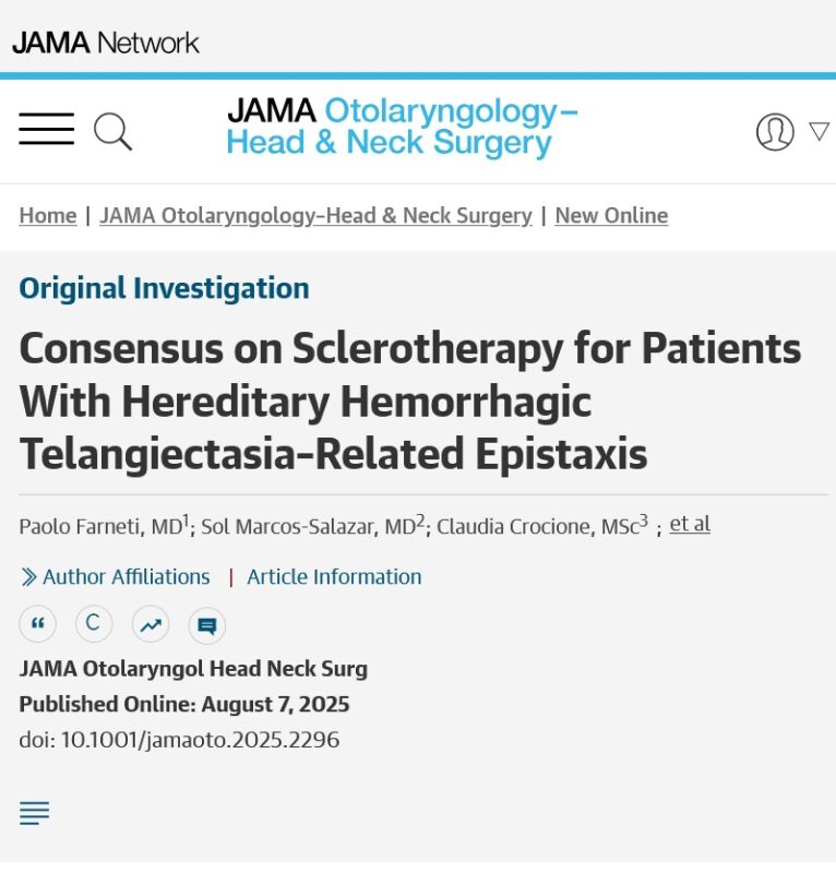 Delphi Consensus: A Safe Guide to Use of Sclerotherapy for Hereditary Hemorrhagic Telangiectasia-related Epistaxis