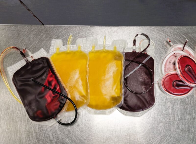 Maxime Dely: Does Whole Blood Deserve a Greater Role in Modern Transfusion Medicine?