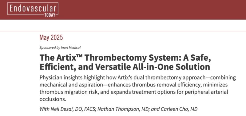 Safe and Efficient Thrombectomy with Artix System: Clinical Insights from Neil Desai and Colleagues