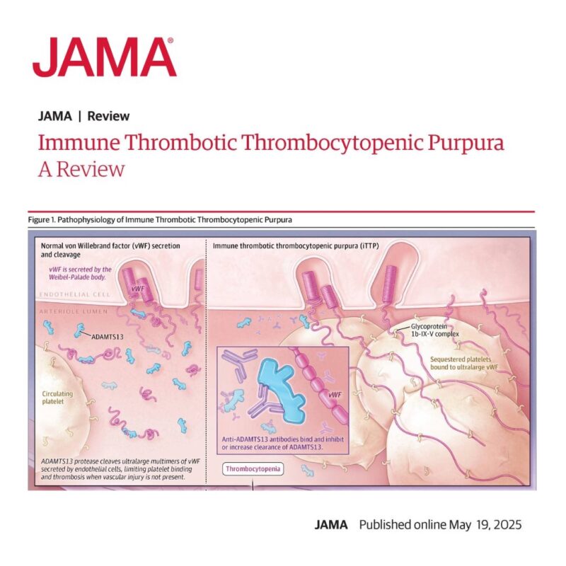 JAMA Review: Immune Thrombotic Thrombocytopenic Purpura (iTTP)