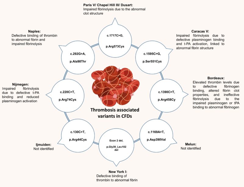 Samin Mohsenian: Thrombotic Paradox in Congenital Fibrinogen Deficiencies