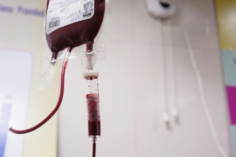 On the Chessboard of Blood Donation: Abdul Mannan Reviews a Complex Case