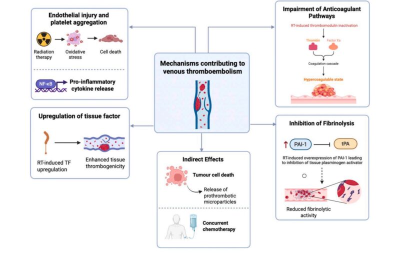 Radiotherapy and VTE Risk: Insights from Marc Carrier and Colleagues