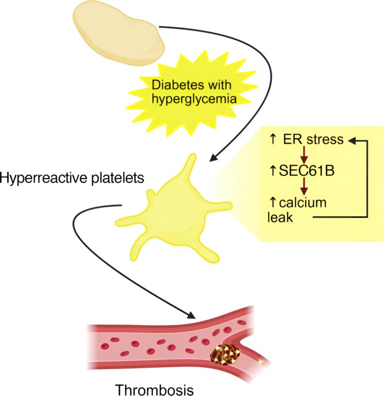 SEC61B Mediated Platelet Hyperactivity in People with Diabetes