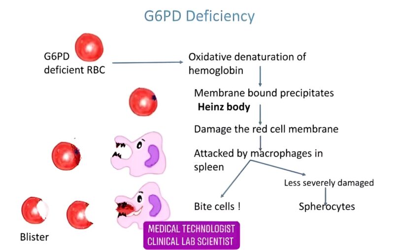 Omar Adwan on G6PD Deficiency: Protecting Red Blood Cells from Oxidative Stress