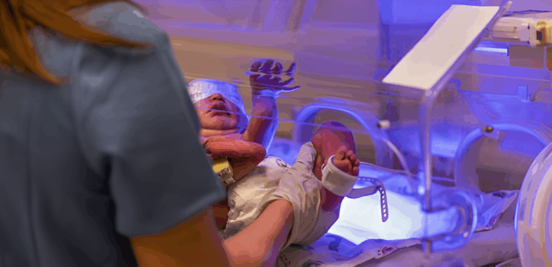 Rare Disease Advisor – Hemolytic Disease Challenges in Neonatal Care