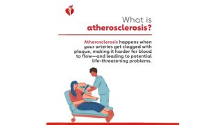 American Heart Association – Fighting Plaque Beyond the Smile