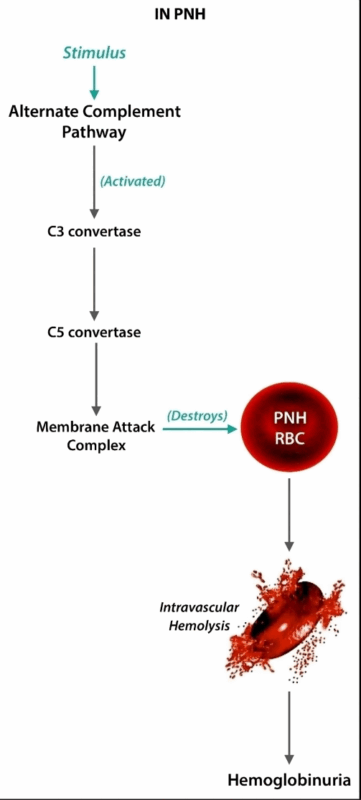 Paroxysmal Nocturnal Haemoglobinuria