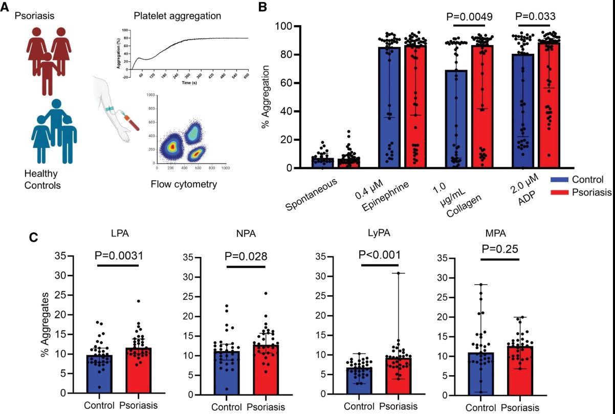 Joel M Gelfand Highlights Platelet RNA Signature in Psoriasis