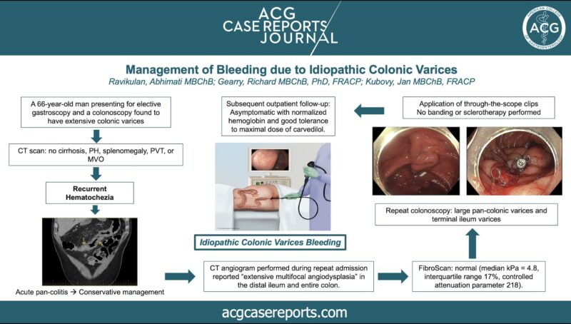 Colonic Varices