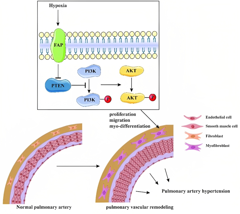 Pulmonary Hypertension
