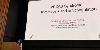 Fernanda Gutierrez-Rodrigues: 2nd VEXAS Workshop has Ended and It was an Amazing Time