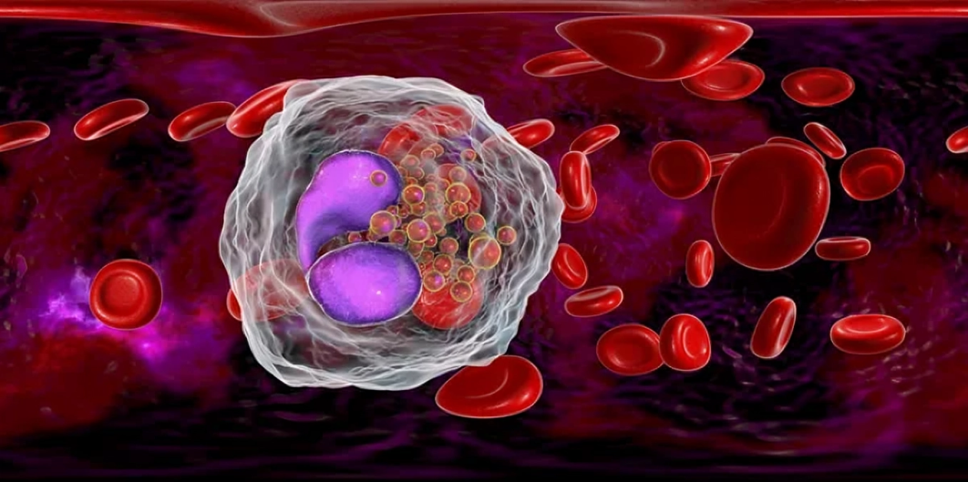 AQUATIC Trial: Validates Stopping ASA Improves Safety and Efficacy in CAD