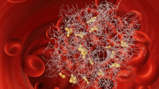 The Fibrinolytic System in Bacterial Sepsis