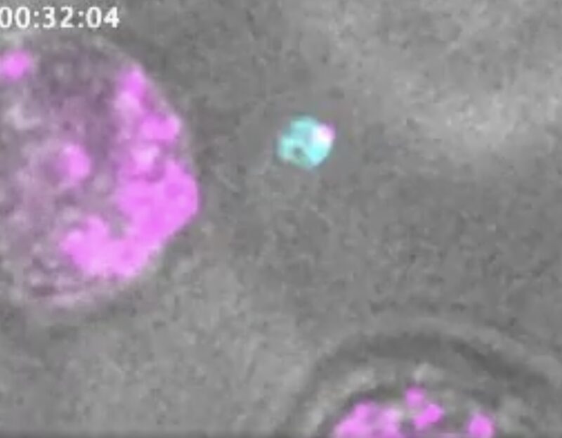 Lauren Murphy: Platelets as DNA “Sponges”