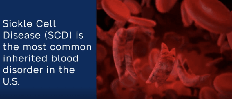 Jan Hartmann Encourages You to Donate for Those with Sickle Cell Disease