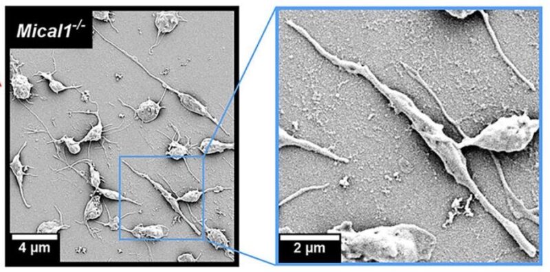 Sébastien Eymieux: Great Collaboration with Alexandre Kauskot to Observe Membrane Deformation of Platelets