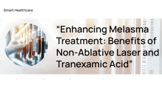 Melasma Treatment Advances: Non-Ablative Laser and Tranexamic Acid Combination Explained