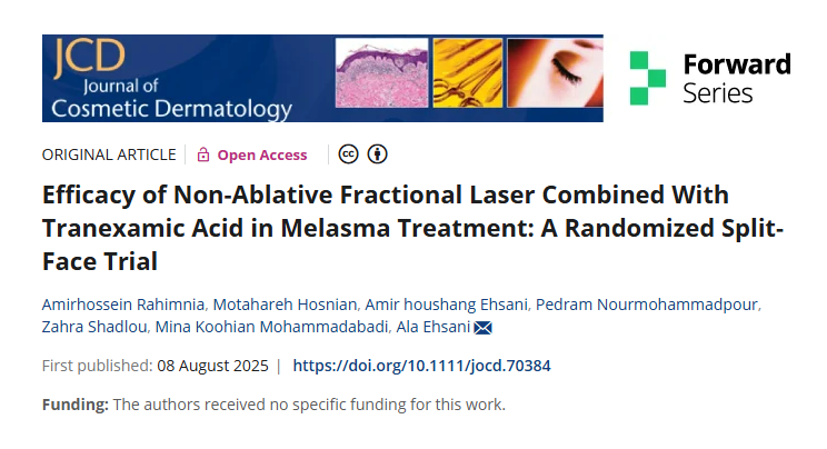 Melasma Treatment