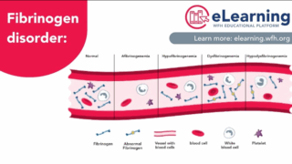 Understanding Fibrinogen Disorders: New Resource from the World Federation of Hemophilia