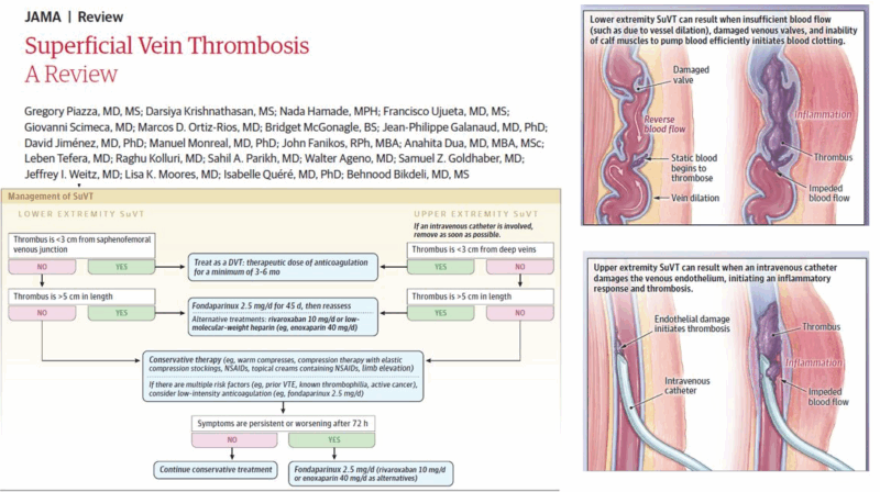 Superficial Vein Thrombosis 