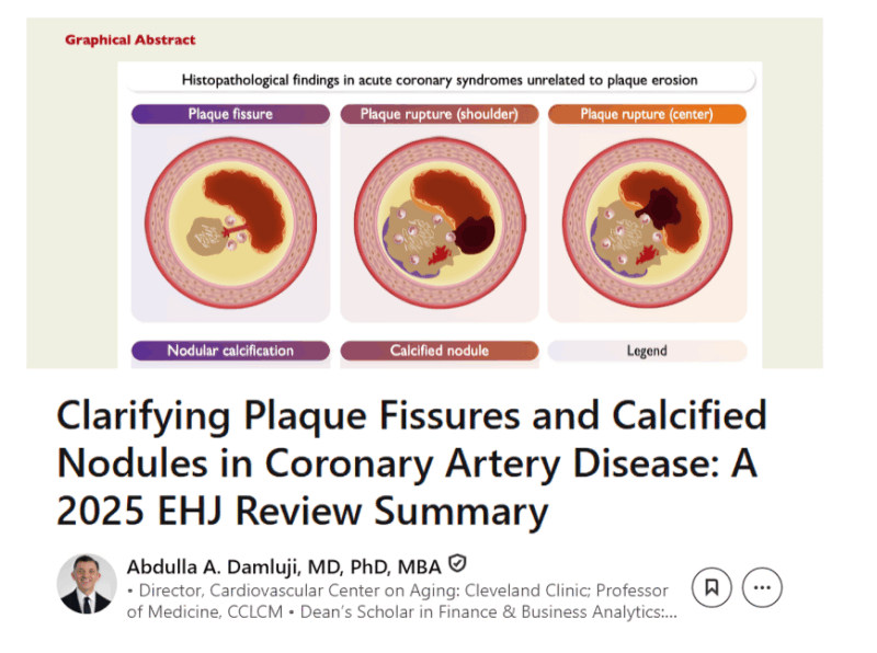 Coronary Artery Disease